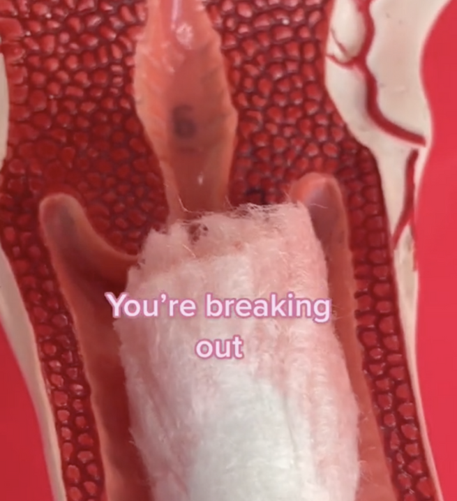 Signs Your Period Is About to Start