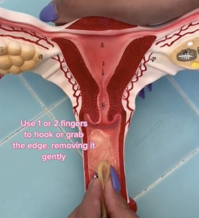 What To Do if a Condom Falls off Inside of You